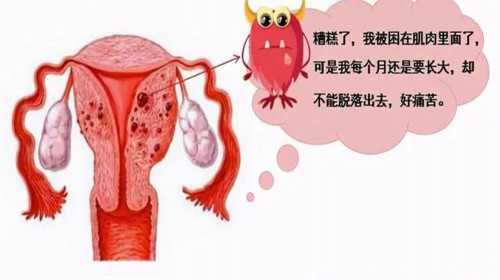 广州代孕合理收费20203|朔州高血压可以做三代试管吗，高血压现在知道还不晚