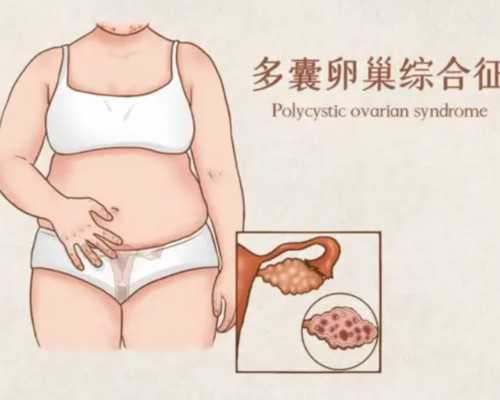 广州供卵试管代怀生子医院排名，附供卵生男孩费用一览！_代怀孕包男孩