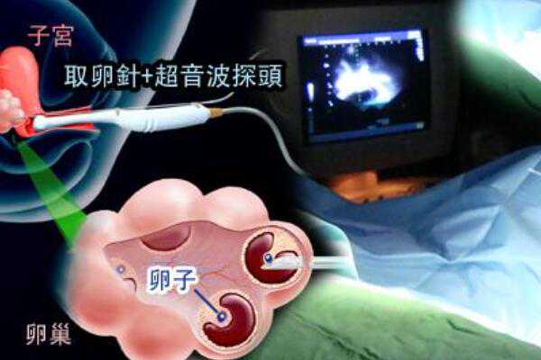 广州哪个助孕机构好,广州三大助孕公司坤和怎么联系-代怀孕价格