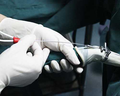 广州供卵自怀费用明细,广州紫朵朵供卵价格-代生小孩过程