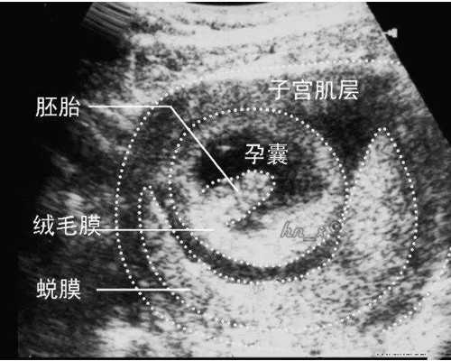 广州好的试管，广州试管婴儿哪儿做好
