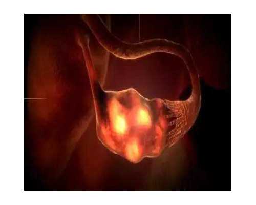 广州供卵医院需要排队吗,广州供卵骗局