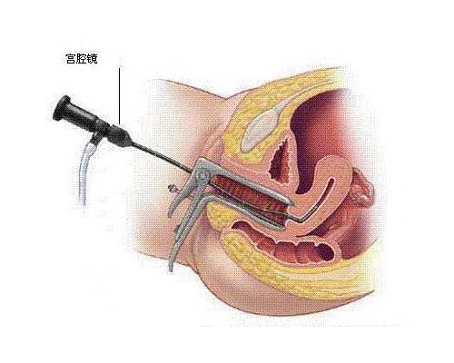 广州代怀最新技术,【北京家恩医院供卵费用】9.25预产期，已寄出超快顺产6.8斤