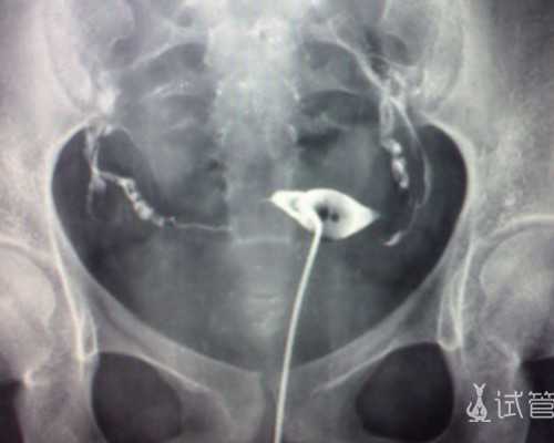 广州找代怀女人,广州合法供卵试管中心供卵有上当的没