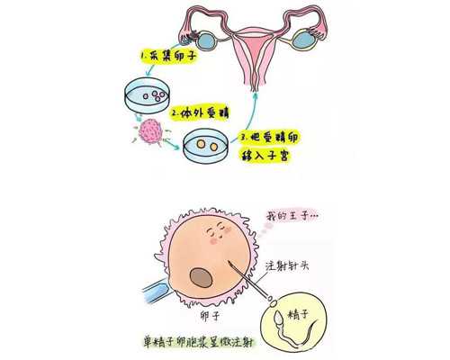 广州供卵成功率,广州卵子库供卵费用清单?-正规代孕哪家好