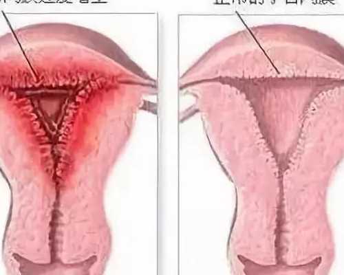 杭州哪个公立可以供卵做三代试管婴儿？