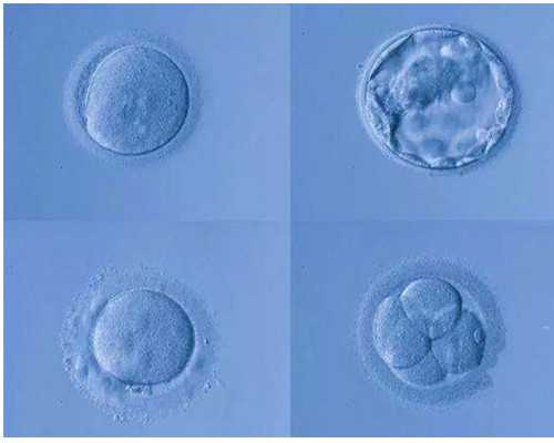 广州有供卵试管婴儿,广州做供卵试管婴儿医院费用